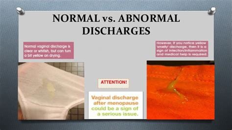 nipple leaking during pregnancy|Normal vs. Abnormal Nipple Discharge: Key Differences and。